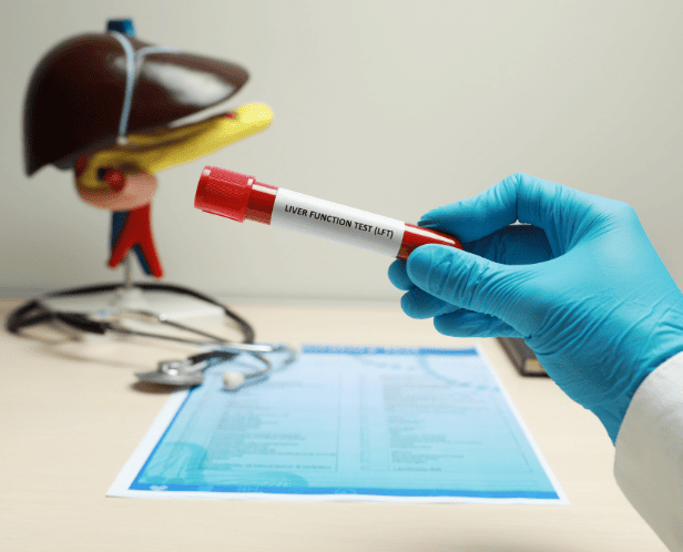 LFT-LIVER FUNCTION TEST