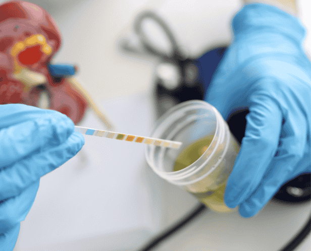 URINE COMPLETE EXAMINATION AUTOMATION