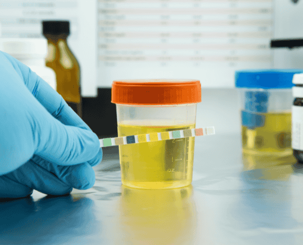 URINE SUGAR (PP)